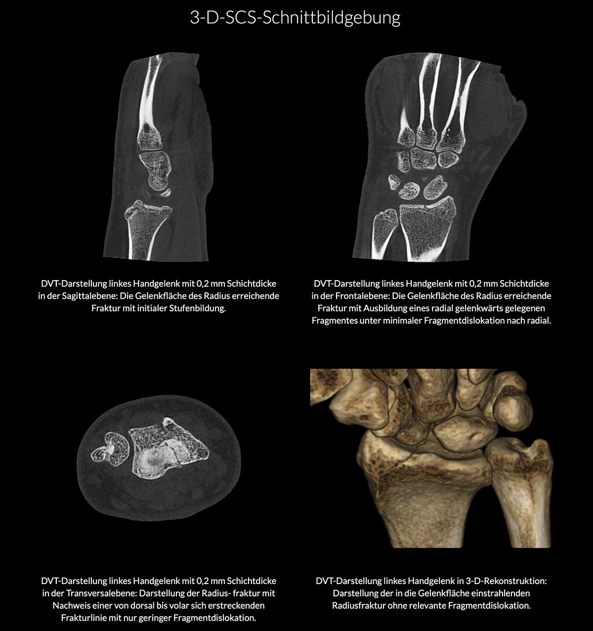 Handgelenk 3D-Röntgen